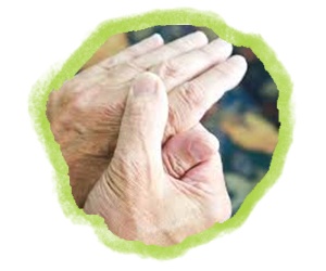 Rheumatoid arthritis Homeopathy Treatment
